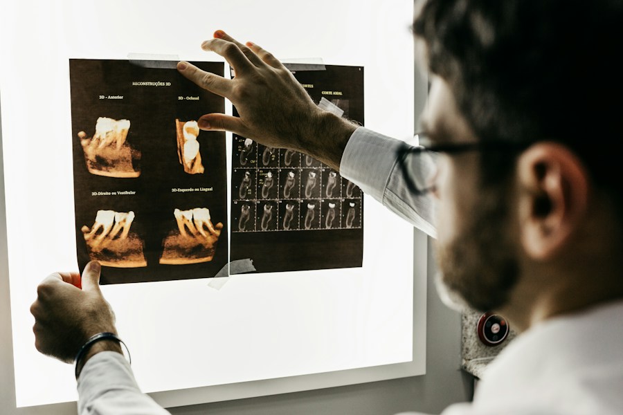 Digital radiograph review for gentle root canal treatment